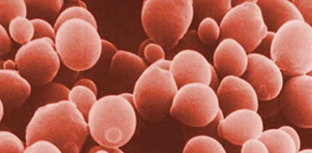 Do You Have Candida/Yeast Overgrowth?